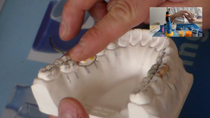 Morphologie dentaire Wax-up 36