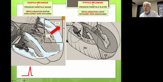 IDM -Tutorat Lecture ECG 2021-Pr Michel Chauvin