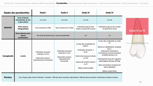 Le diagnostic parodontal.mp4