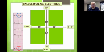 7 les axes électriques et les hémiblocs