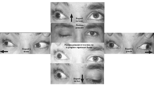 Conférence ECOS#11 - ORL & Opthalmologie