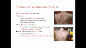 Syndromes canalaires