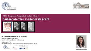 DFGSO3 Radio RX Profil - RadioAnatomie