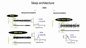 sommeil et narcolepsie 