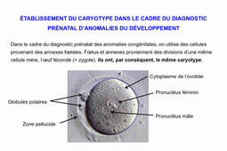 3. Le caryotype-ORTHOPTIE