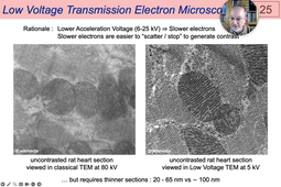 02 - Electron Microscopy - The Transmission Electron Microscope.mp4