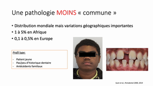 Implications systémiques des pathologies parodontales