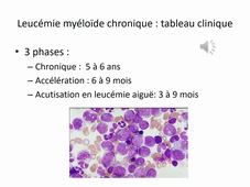 Hémopathies myéloïdes DFGSO3