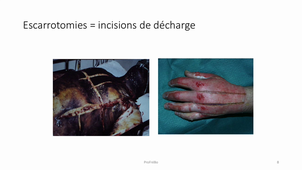 TD19N plastique partie 4
