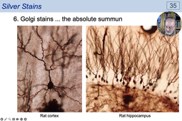 05 - Classical Staining Techniques - Silver Stains.mp4