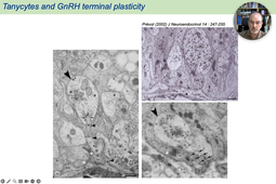 09 - Gonadotropic Axis & Tanycytes.mp4