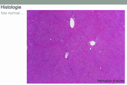 module G1A TD anapath inflammation