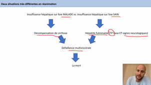 Insuffisance hépatique (Artzner)