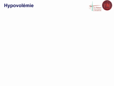Remplissage vasculaire Collange