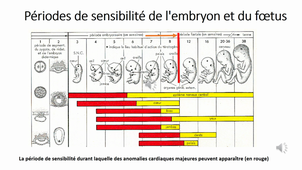 TD_cardio-vasculaire Pr TELETIN